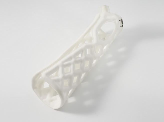 Liquid exoskeleton(brace)--Medical External Fixation Brace (Hand)