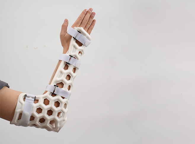 Liquid exoskeleton(brace) –Medical External Fixation Device (Elbow)