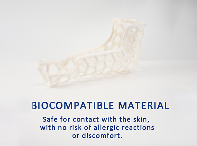 Liquid exoskeleton(brace) --Medical External Fixation Device (Elbow)