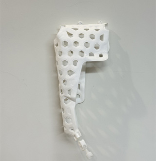 Medical-External-Fixation-Device-Elbow-6