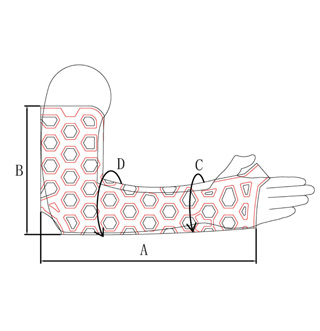 Medical-External-Fixation-Device-Elbow-8