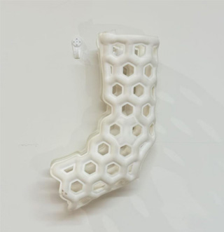Medical-External-Fixation-Device-Foot-108-12