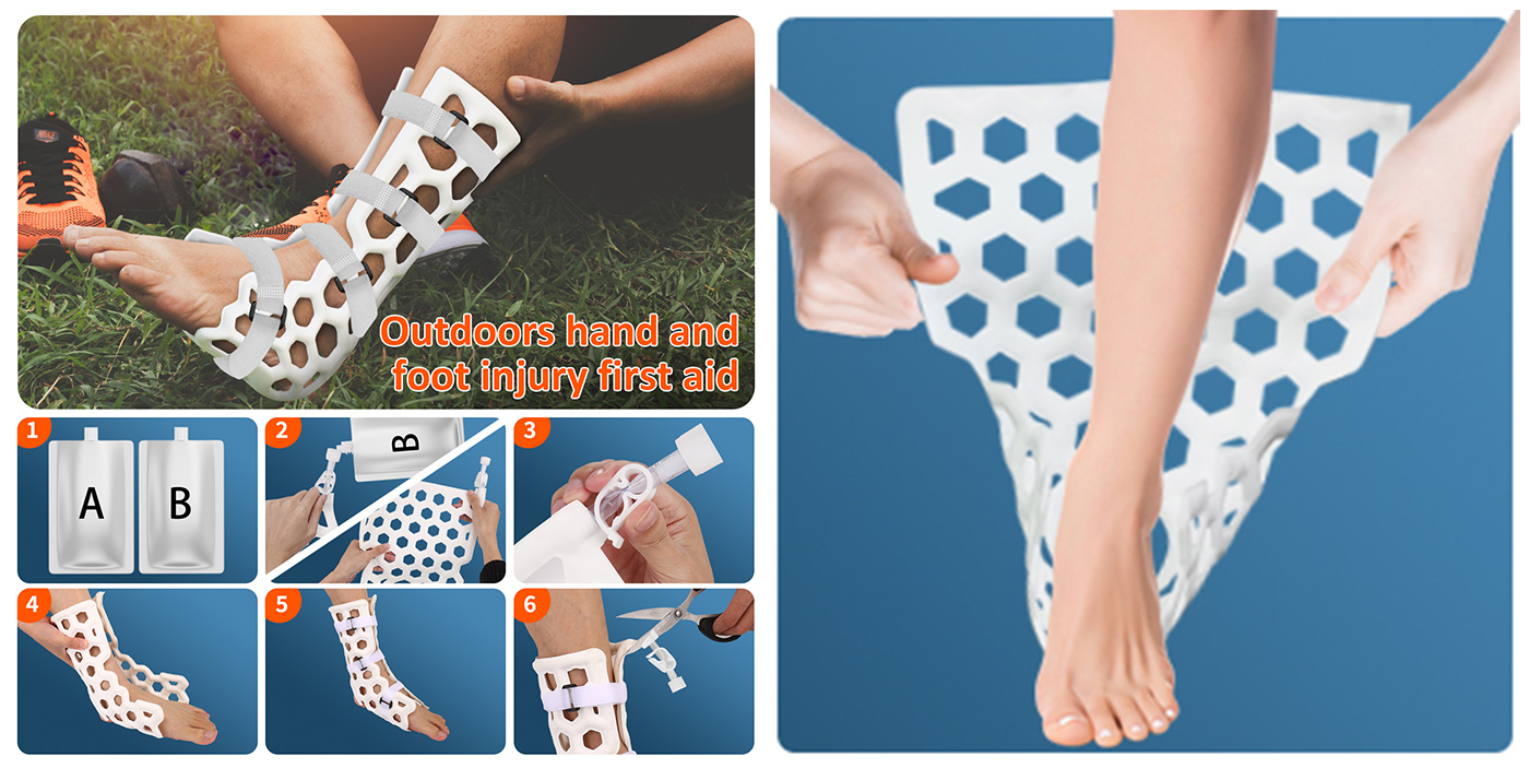 Medical-External-Fixation-Device-Foot-90-5