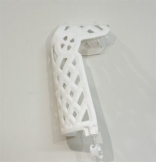 Medical-External-Fixation-Device-Foot-90-6