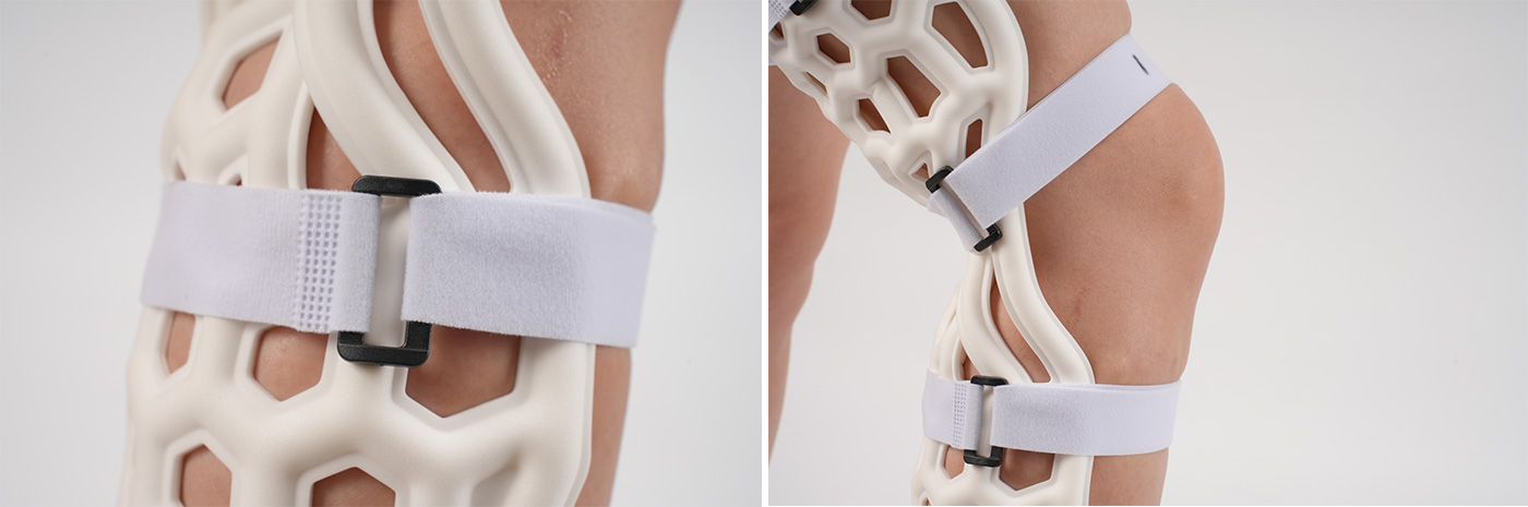 Medical-External-Fixation-Device-Leg-4
