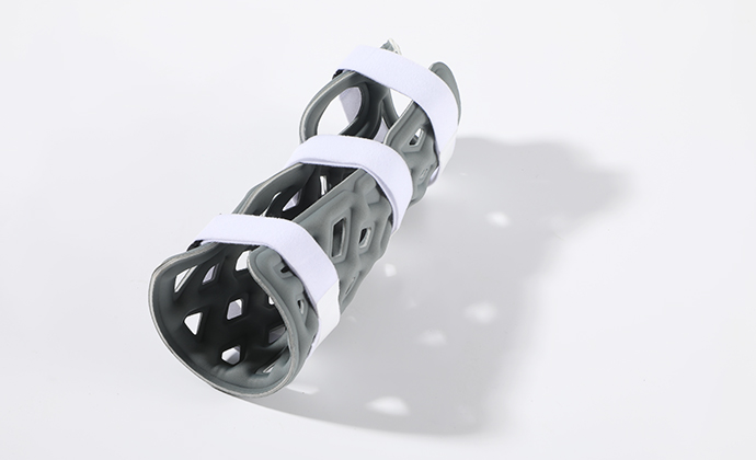 Liquid Exoskeleton (Brace) – Customized Medical External Fixation Device (Hand)