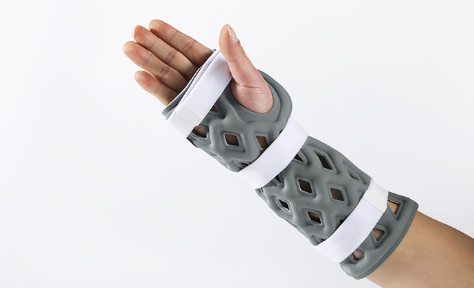 Liquid Exoskeleton (Brace) – Customized Medical External Fixation Device (Hand)